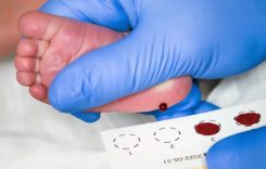 topuk-kani-taramasi-testi-10